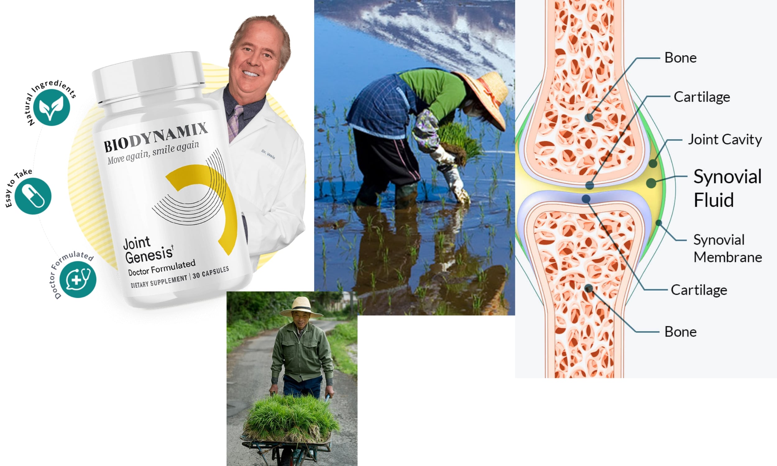 Achieve Optimal Joint Health A Comprehensive Guide